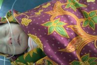 Kondisi bayi penuh luka, diduga akibat cakaran dan gigitan anjing