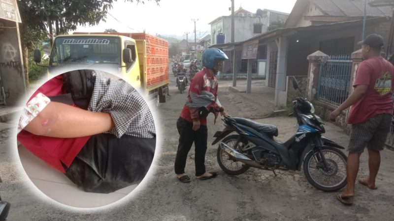 Korban laka tunggal, Ronal, yang alami luka baret dan terkilir pada Sikut Kanan Tangan dan Paha hingga Lutut Kanan Kakinya