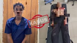 Korban Mengalami Luka Serius, CCTV Toko Yanti Jadi Petunjuk Awal Pengungkapan Peristiwa